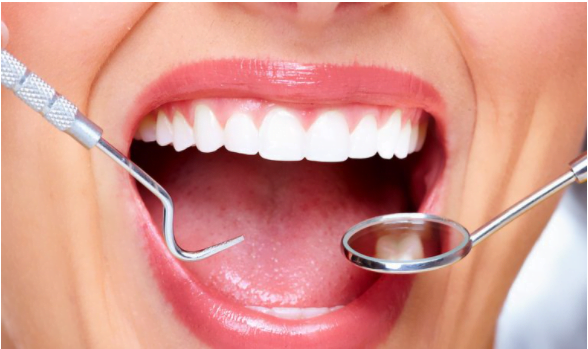 علاج الاسنان المتقدمه بدون تقويم بطرق مجربة